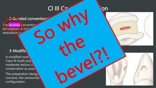 Cl III Cavity Preparation
2-Beveled conventional Class III Tooth Preparation
The beveled conventional tooth preparation for composite
restorations is indicated primarily for replacing an existing defective
restoration in the crown portion of the tooth.
3-Modified Class III tooth Preparation
A modified tooth preparation is the most used type of
Class III tooth preparation. It is indicated for small and
moderate lesions or faults and is designed to be as
conservative as possible
The preparation design appears to be "scooped" or
concave, the cavosurface margins in a beveled
configuration
 