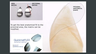 To get the best anatomical fit to the
proximal area, the matrix can be
modified.
 