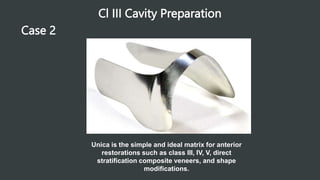 Cl III Cavity Preparation
Case 2
Unica is the simple and ideal matrix for anterior
restorations such as class III, IV, V, direct
stratification composite veneers, and shape
modifications.
 
