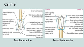 Canine
Maxillary canine Mandibular canine
 