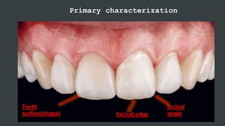 Primary characterization
Tooth
outline(shape)
Incisal
angle
Incisal edge
 
