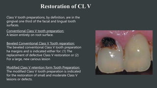 Restoration of CL V
Class V tooth preparations, by definition, are in the
gingival one third of the facial and lingual tooth
surfaces.
Conventional Class V tooth preparation:
A lesion entirely on root surface.
Beveled Conventional Class V Tooth reparation:
The beveled conventional Class V tooth preparation
ha margins and is indicated either for: (1) The
replacement of defective Class V restoration or (2)
For a large, new carious lesion
Modified Class V retention form Tooth Preparation:
The modified Class V tooth preparation is indicated
for the restoration of small and moderate Class V
lesions or defects.
 