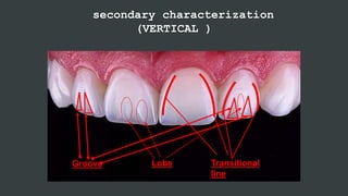 secondary characterization
(VERTICAL )
Lobs Transitional
line
Groove
 