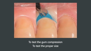 To test the gum compression
To test the proper size
 