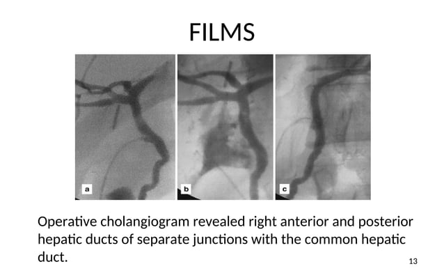 TOPIC MEDICAL IMAGING OPERATIVE CHOLANGIOGRAPHY.ppt