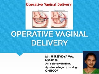 OPERATIVE VAGINAL
DELIVERY
 