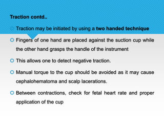 Traction contd..
 Traction may be initiated by using a two handed technique
 Fingers of one hand are placed against the suction cup while
the other hand grasps the handle of the instrument
 This allows one to detect negative traction.
 Manual torque to the cup should be avoided as it may cause
cephalohematoma and scalp lacerations.
 Between contractions, check for fetal heart rate and proper
application of the cup
 