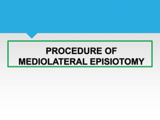 PROCEDURE OF
MEDIOLATERAL EPISIOTOMY
 