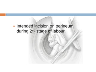 Classical Incision Labour Comprehensive Guide to Operative Delivery Techniques and Complications ...