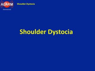 Shoulder Dystocia
International
Shoulder Dystocia
 