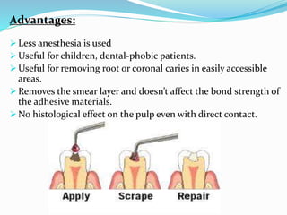 Advantages:
 Less anesthesia is used
 Useful for children, dental‐phobic patients.
 Useful for removing root or coronal caries in easily accessible
areas.
 Removes the smear layer and doesn’t affect the bond strength of
the adhesive materials.
 No histological effect on the pulp even with direct contact.
 
