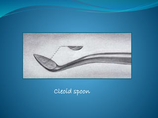 Cleoid spoon
 