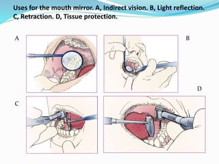Uses for the mouth mirror. A, Indirect vision. B, Light reflection.
C, Retraction. D, Tissue protection.
A
D
C
B
 