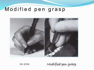 M o d i f i e d p e n g r a s p
pen grasp Modified pen grasp
 