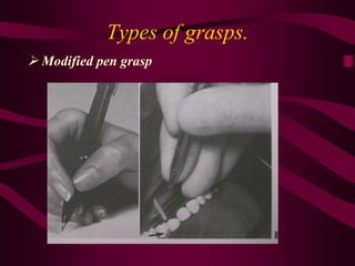 Types of grasps.
 Modified pen grasp
 