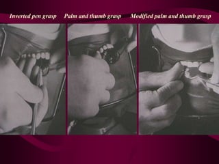 Inverted pen grasp Palm and thumb grasp Modified palm and thumb grasp
 