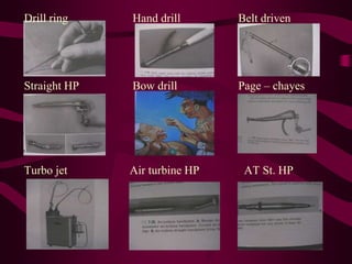 Drill ring Hand drill Belt driven
Straight HP Bow drill Page – chayes
Turbo jet Air turbine HP AT St. HP
 