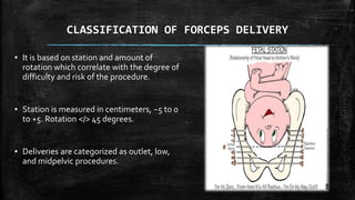 CLASSIFICATION OF FORCEPS DELIVERY
▪ It is based on station and amount of
rotation which correlate with the degree of
difficulty and risk of the procedure.
▪ Station is measured in centimeters, −5 to 0
to +5. Rotation </> 45 degrees.
▪ Deliveries are categorized as outlet, low,
and midpelvic procedures.
 