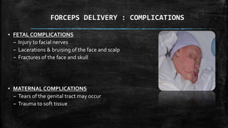 FORCEPS DELIVERY : COMPLICATIONS
▪ FETAL COMPLICATIONS
– Injury to facial nerves
– Lacerations & bruising of the face and scalp
– Fractures of the face and skull
▪ MATERNAL COMPLICATIONS
– Tears of the genital tract may occur
– Trauma to soft tissue
 