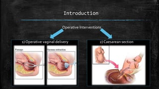 Introduction
Operative Interventions
1) Operative vaginal delivery 2) Caesarean section
 