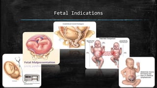 Fetal Indications
 