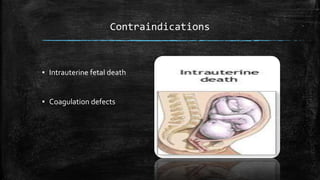 Contraindications
▪ Intrauterine fetal death
▪ Coagulation defects
 