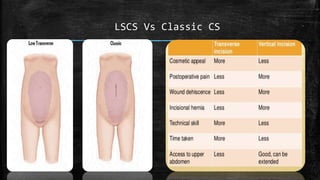 LSCS Vs Classic CS
 