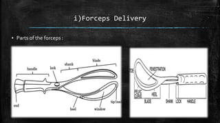 i)Forceps Delivery
▪ Parts of the forceps :
 