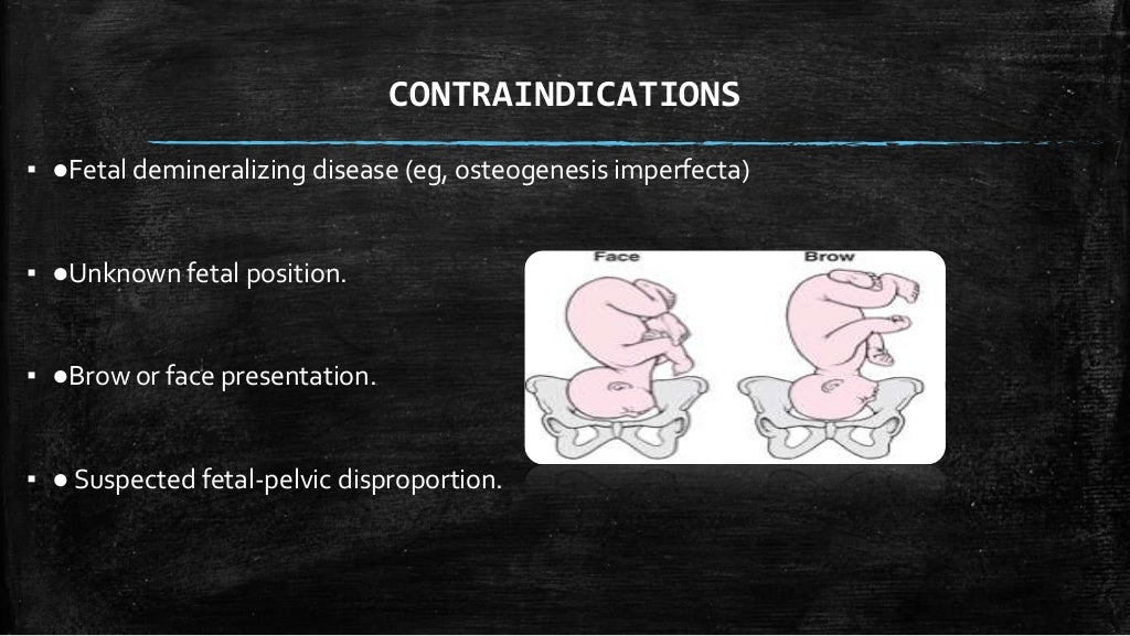 Operative Interventions In Obstetrics