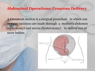 Operative obstetrics | PPTX