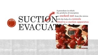 A procedure in which
the products of conception
are sucked out from the uterus
with the help of a cannula
fitted to a suction apparatus
 