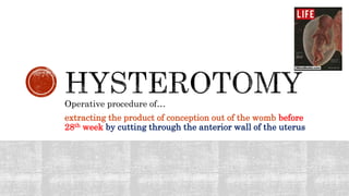 Operative procedure of…
extracting the product of conception out of the womb before
28th week by cutting through the anterior wall of the uterus
 