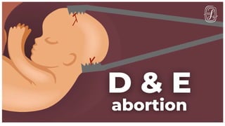 Operative_obstetrics_Presentation3[1].pptx