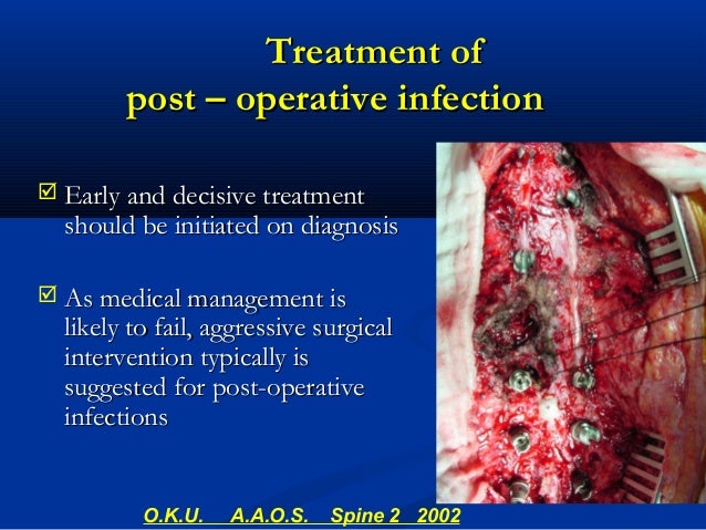 Complications in Spine Surgery