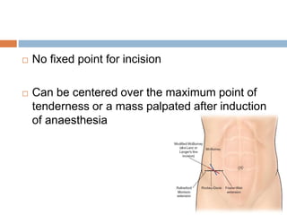  No fixed point for incision
 Can be centered over the maximum point of
tenderness or a mass palpated after induction
of anaesthesia
 