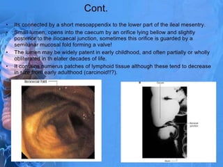 Operative surgery appendix | PPTX