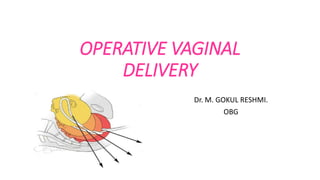 OPERATIVE VAGINAL
DELIVERY
Dr. M. GOKUL RESHMI.
OBG
 