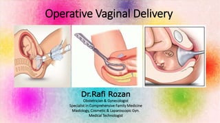 Operative Vaginal Delivery
Dr.Rafi Rozan
Obstetrician & Gynecologist
Specialist in Comprehensive Family Medicine
Mastology, Cosmetic & Laparoscopic Gyn.
Medical Technologist
 