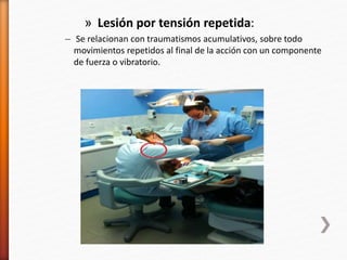 » Lesión por tensión repetida:
– Se relacionan con traumatismos acumulativos, sobre todo
movimientos repetidos al final de la acción con un componente
de fuerza o vibratorio.
 