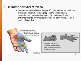 » Síndrome del túnel carpiano
– Es una afección en la cual hay presión sobre el nervio mediano,
el nervio de la muñeca que proporciona sensibilidad y
movimiento a partes de la mano. Esto puede ocasionar
entumecimiento, hormigueo, debilidad o daño muscular en la
mano y los dedos.
 