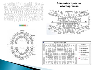 Diferentes tipos de 
odontogramas 
 