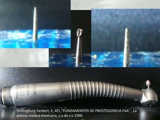 Shillingburgherbert, E, ATL,"FUNDAMENTOS DE PROSTODONCIA FIJA" , La prensa medica mexicana, s.a de c.v 1990