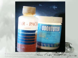 © 2004 Dentsply International All rights reserved © 2004 Dentsply InternationalEspinosa Caceres Daniela, “Microfiltracion de cementostemporales en cavidadesclase II, invitro”  , 2002 , 