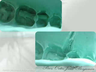 PegoraroLuiz Fernando, Et al, Protesis Fija  2001