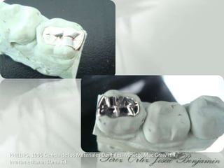 PHILLIPS, 1996 Ciencia de los Materiales Dentales, Mexico: Mac Graw Hill Interamericana: 10ma Ed.