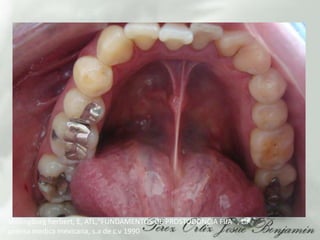 Shillingburgherbert, E, ATL,"FUNDAMENTOS DE PROSTODONCIA FIJA" , La prensa medica mexicana, s.a de c.v 1990