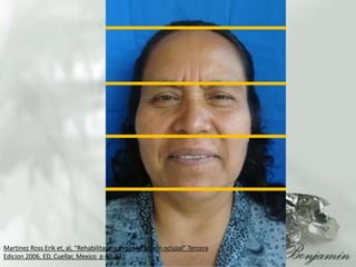 Martinez Ross Erik et, al, “Rehabilitacion y recontruccionoclusal” Tercera Edicion 2006, ED, Cuellar, Mexico  p 40, 431