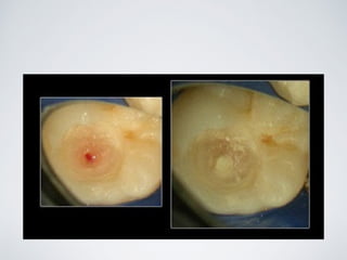 Nicolás Pérez Quiroz
Cirujano Dentista
 