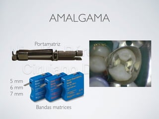 Nicolás Pérez Quiroz
Cirujano Dentista
AMALGAMA
5 mm
6 mm
7 mm
Portamatriz
Bandas matrices
 
