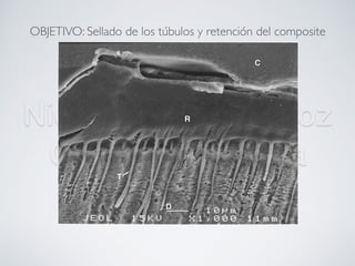 Nicolás Pérez Quiroz
Cirujano Dentista
OBJETIVO: Sellado de los túbulos y retención del composite
 